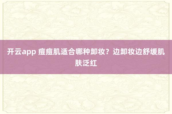 开云app 痘痘肌适合哪种卸妆?边卸妆边舒缓肌肤泛红